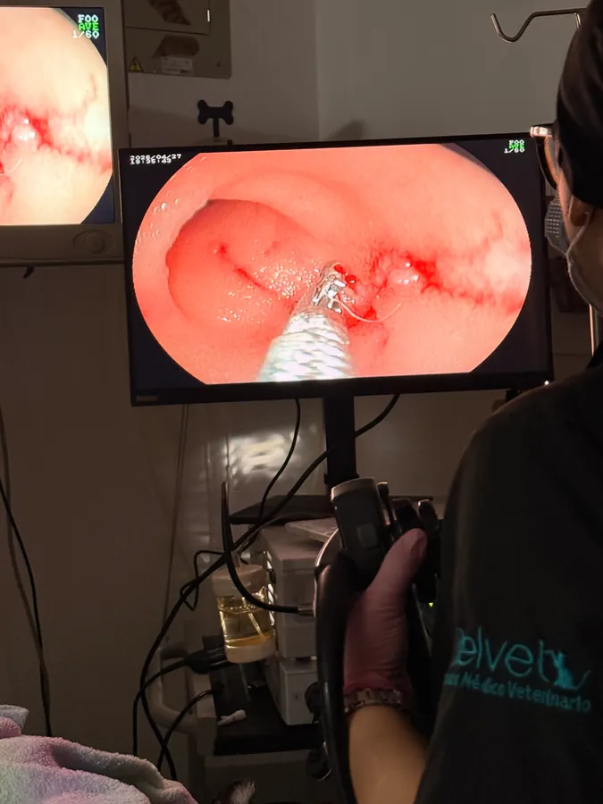Procedimiento endoscópico en Belvet, con la imagen de la cámara en el monitor
